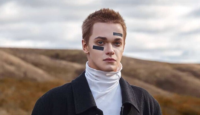 Побитий танцюрист Дорофєєвої переніс складну операцію на голові - частину черепа замінили пластиною