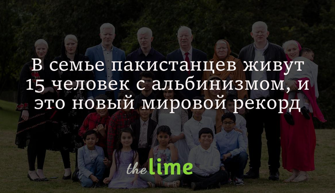 У родині пакистанців живуть 15 людей з альбінізмом, і це новий світовий рекорд: фото