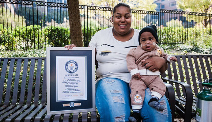 Хлопчик народився на 19 тижнів раніше терміну і став світовим рекордсменом. Його порятунок – справжнє диво