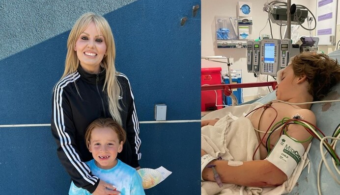 Наклали 20 швів: онук покійного Григорія Чапкіса постраждав у ДТП