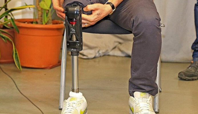 Нога за рік не виросла: як комісії МСЕК знущаються над людьми