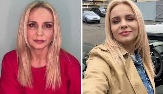 Лілії Ребрик дорікнули через синці під очима: акторка відповіла на критику