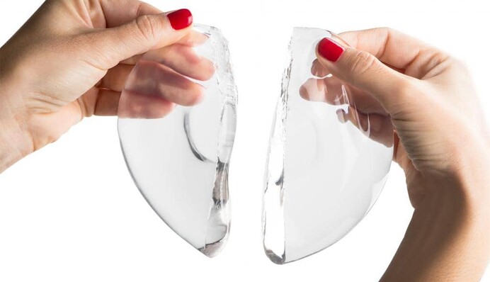 А хіба це ділиться: як суддя перетворив частини тіла на майно