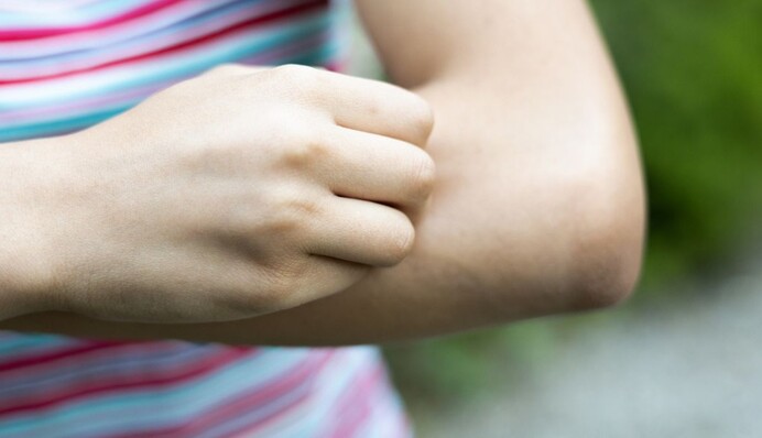 Топ-6 натуральних засобів, які захищають від укусів комарів та інших комах