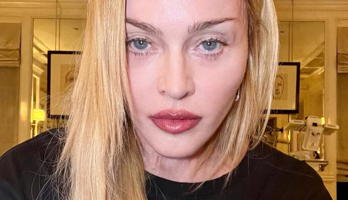 Мадонна впервые прокомментировала свое состояние и показала фото после госпитализации