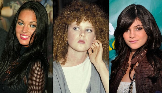 Не только Мадонна: звезды, которые до неузнаваемости изменились из-за пластики и возраста