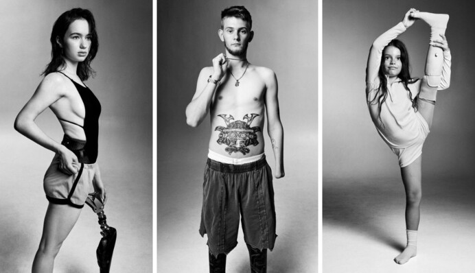 Військові і цивільні: на шпальтах Vogue з'явилися українці, які втратили кінцівки через війну