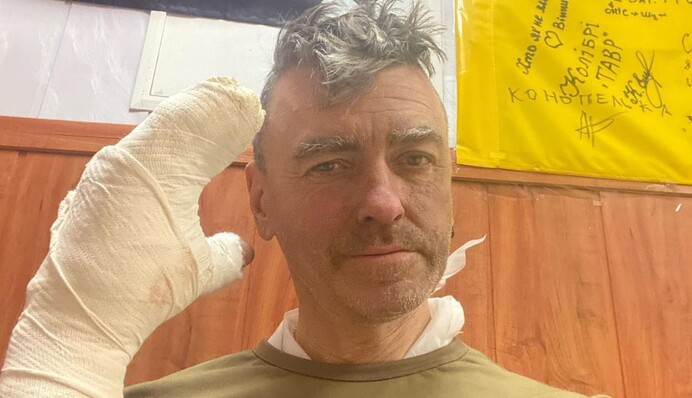 Муж Евгении Гапчинской получил ранения на фронте: художница рассказала о его состоянии