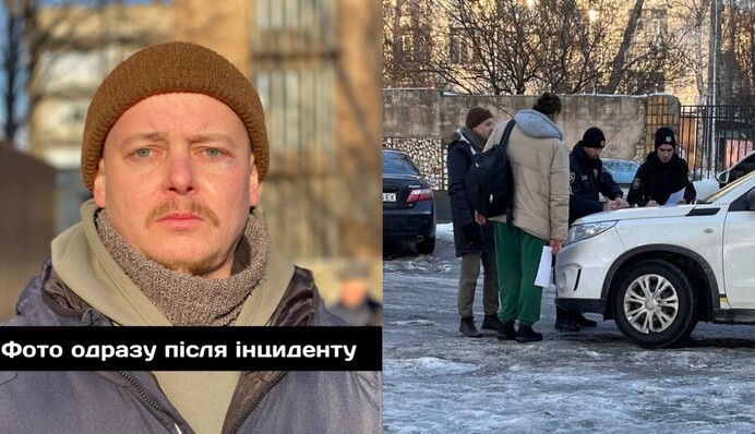 Актор Лемешко заявив, що його побив директор Дніпровського оперного театру: що відомо про інцидент