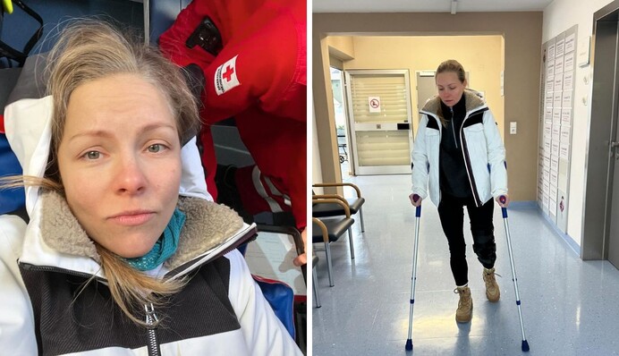 Олена Шоптенка показалася на милицях і розповіла про нещасний випадок: фото