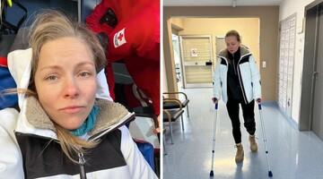 Олена Шоптенка показалася на милицях і розповіла про нещасний випадок: фото