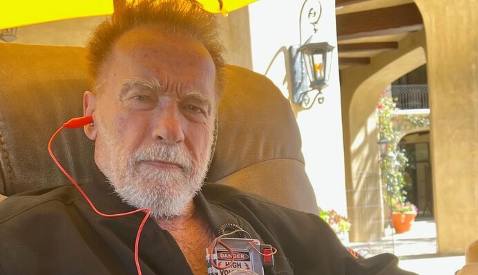 Шварценеггер після встановлення кардіостимулятора показав жартівливе фото з пристроєм: йому повірили