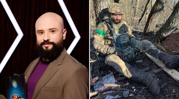 Дуже складна травма: комік Віктор Розовий на фронті отримав серйозне поранення голови