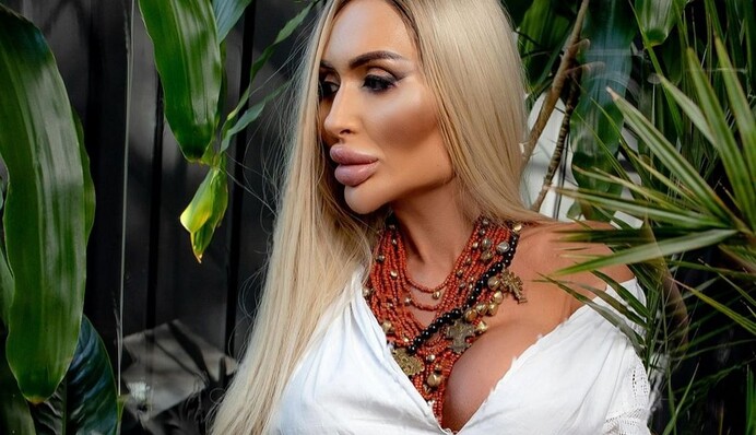 Українка з найбільшими у світі вилицями назвала найболючішу пластичну операцію