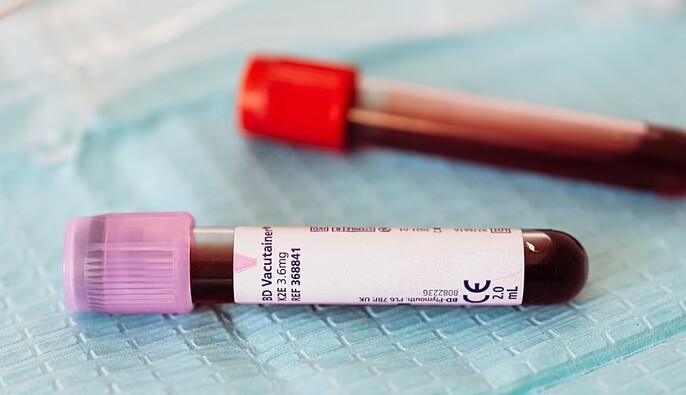 Троє людей померли від вірусу Марбург в Ефіопії