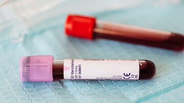 Три человека скончались от вируса Марбург в Эфиопии