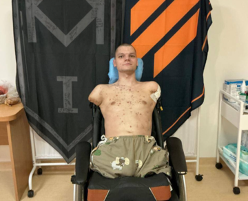 Інцидент з ветераном: "Приватбанк" перепросив та пообіцяв покрити лікування й протезування