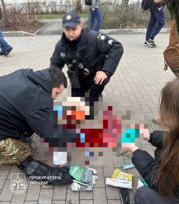 В больнице скончалась женщина, получившая тяжелые ранения в Киеве во время удара РФ 23 декабря