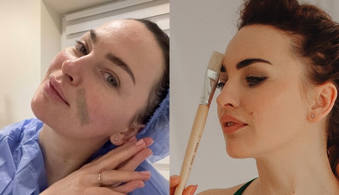 "Буду только уменьшаться": Виктория Булитко рассказала о своей первой пластической операции