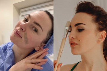 "Буду лише зменшуватись": Вікторія Булітко розповіла про свою першу пластичну операцію