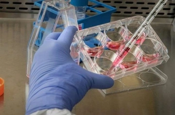 ВОЗ объявит завершение вспышки хантавируса в июле, если не будет новых случаев заболевания