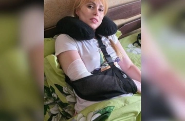 В Харькове адвокат получила инвалидность после избиения в ТЦК — Лубинец