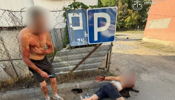 У Києві повідомили підозру 19-річному містянину у замаху на вбивство 