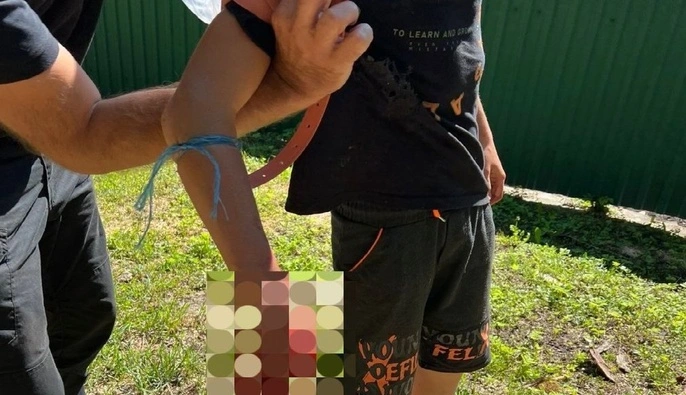 В Сумской области ребенок принес домой взрывоопасный предмет: пострадали мальчик и его мать