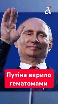 🔥Сліди від крапельниць? Кадри з Путіним ОБЛЕТІЛИ МЕРЕЖУ – дивіться що помітили ЗМІ #shorts #путин