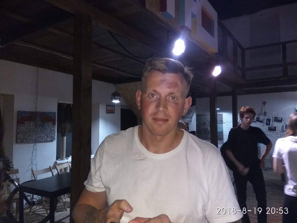 ​У Маріуполі невідомі в балаклавах напали на активістів: опубліковані фото